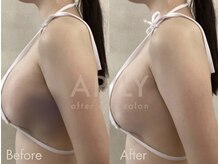 アリリィ(ARILY)/インディバダウンタイム/表参道