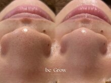 ビーグロウ(be Grow)/一度でこの変化