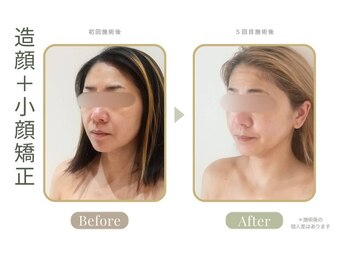 マーリエ(Malie)の写真/眠れるほど心地よい施術で、首肩デコルテ・ヘッドまでケアし小顔へ導く◎
