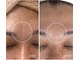 ココビ(COCOVi)の写真/【シミ・しわ・毛穴悩みに】40代、50代に大人気！シミ・くすみの改善、素肌でも自信がもてる肌に☆
