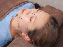 ビバリ(VIBARI)の雰囲気（鍼灸/美容鍼/骨盤矯正/整体◎メンズの方も大歓迎です♪）