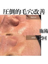 サロンツキ(salon tuki)/お客様症例/光フォト