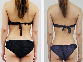 マナ(mana)/大食いアラフォーオーナー実体験