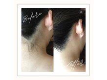 ラベニール(La Benir)/夏に人気のうなじ脱毛