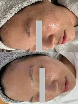 イーサロン(eii salon)/20代女性