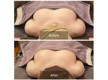 ベンザイ 梅田店(BENZAI)/バストの流れ、リラクゼーション