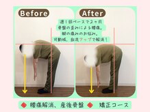 整体院リフィール/Before&After【骨盤/姿勢/整体】