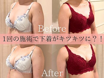 ナリッシュ バスト 六本木(Nouriche Bust)/バストアップはナリッシュバスト