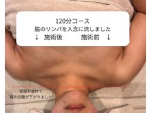 フクシア(FUCSHIA)/嬉しい変化！