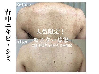 ローズフィールド(Rosefield)の写真