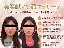 れんげ鍼灸整骨院
