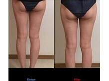 サロン シエラ/施術5回　50代