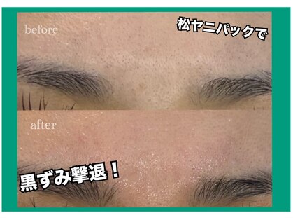 アネラ(ANELA)の写真