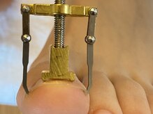 エムネイル(Mnail)