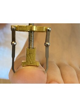 爪の悩みを解消できる（ケア含む）