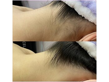 エルマナ(Hermana)/