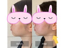 ヨサパーク ルアナ 高島店(YOSA PARK Luana)/顔ちっちゃ！よもぎ蒸し