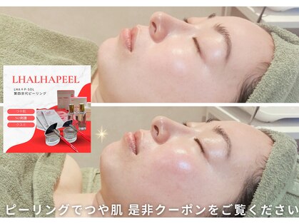 リムビューティー 自由が丘(RymBeauty)の写真