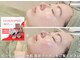 リムビューティー 自由が丘(RymBeauty)の写真