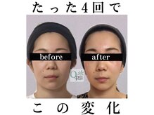 キュープ 北千住店(Qpu)