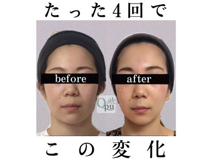 キュープ 北千住店(Qpu)の写真