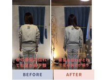 当院独自の技術！CRライン（中枢リセット整体）一回で違いがでる