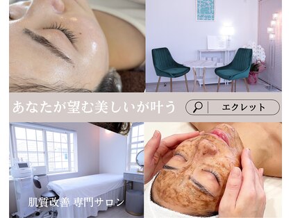 エクレットの写真