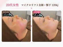 リフト 西船橋(Lift)/【西船橋】小顔・痩身専門店Lift