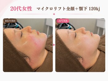 リフト 西船橋(Lift)/【西船橋】小顔・痩身専門店Lift