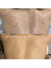クレア(CLEA)/背中ニキビにはハーブリプロ