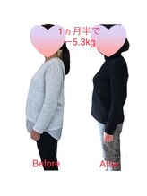 ヴェリテ(Verite)/before after