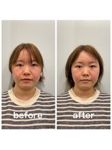 美容整体プラスフィール 横浜店/美容整体/エステ/リラク