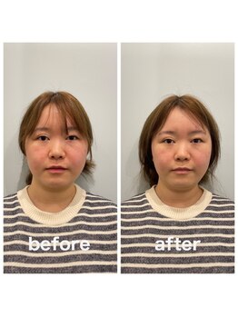 美容整体プラスフィール 横浜店/美容整体/エステ/リラク