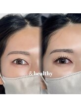 ウル(ulu)/＆healthy 100本