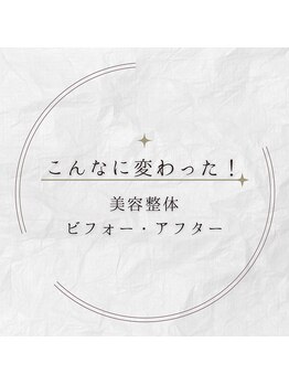 キアラ(chiara)/ビフォー・アフター特集↓