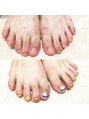 マニエネイル(mani e nail) 【フットの深爪矯正】スカルプで足の深爪も巻き爪矯正も可。