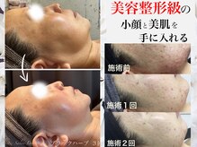 リアン(Lien)