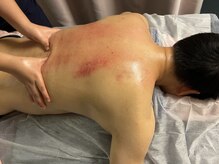 健楽庵整体院/施術シーン7