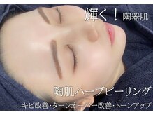 エムラボ 麻布十番店(M LABO)の雰囲気（中々改善されない肌荒れに「植物性幹細胞」入のハーブがオススメ）