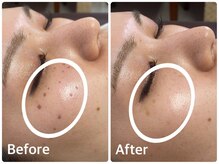 ラウレア(LAULEA)