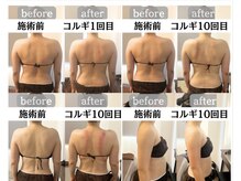 ビオルネ(VIE.ORNER)/BeforeAfter