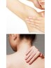【8月限定】サクッと部分脱毛！夏の脇＋うなじセット★8000円→5500円