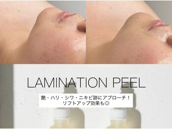 エナソール(Enasol)の写真/韓国発の次世代美容！【肌を育てる】新感覚ピーリングで、シミや小ジワを改善。透明感たっぷりの艶肌へ♪