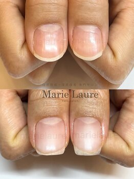 マリーロール 梅田店(Marie Laure)/深爪矯正/自爪育成/ネイルケア