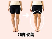 シャルモン イブ(Charmont Eve)の雰囲気（諦めていたO脚。骨の歪みは戻ります！！美脚目指しませんか？）