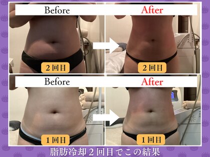 クローネ(Krone)の写真