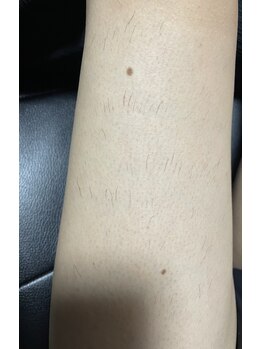 モルト(MOLT)/まだらなのは