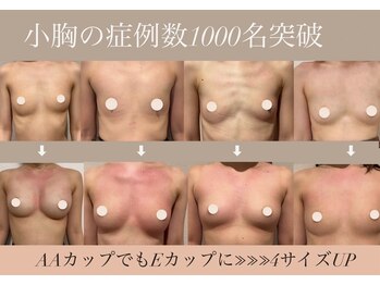 アーレ 福岡天神店(ARE)