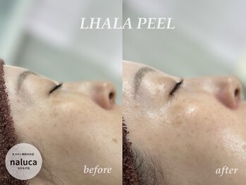 ナルカ(naluca)/【堺市北区・中もず】ララピール