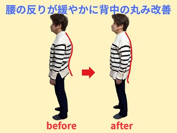 はしもと鍼灸整骨院/腰の反り、背中の丸み改善